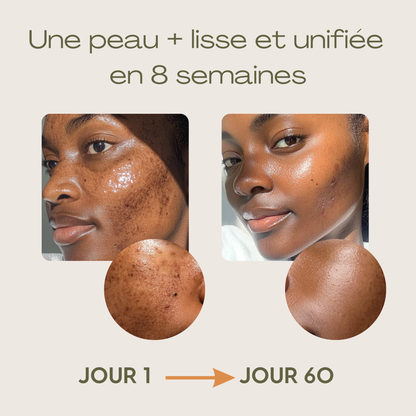 Sérum Anti-Imperfections 3 en 1