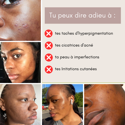 Pads 3 en 1 au Curcuma