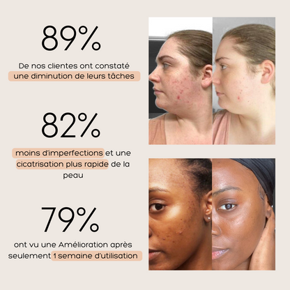 Sérum Anti-Imperfections 3 en 1
