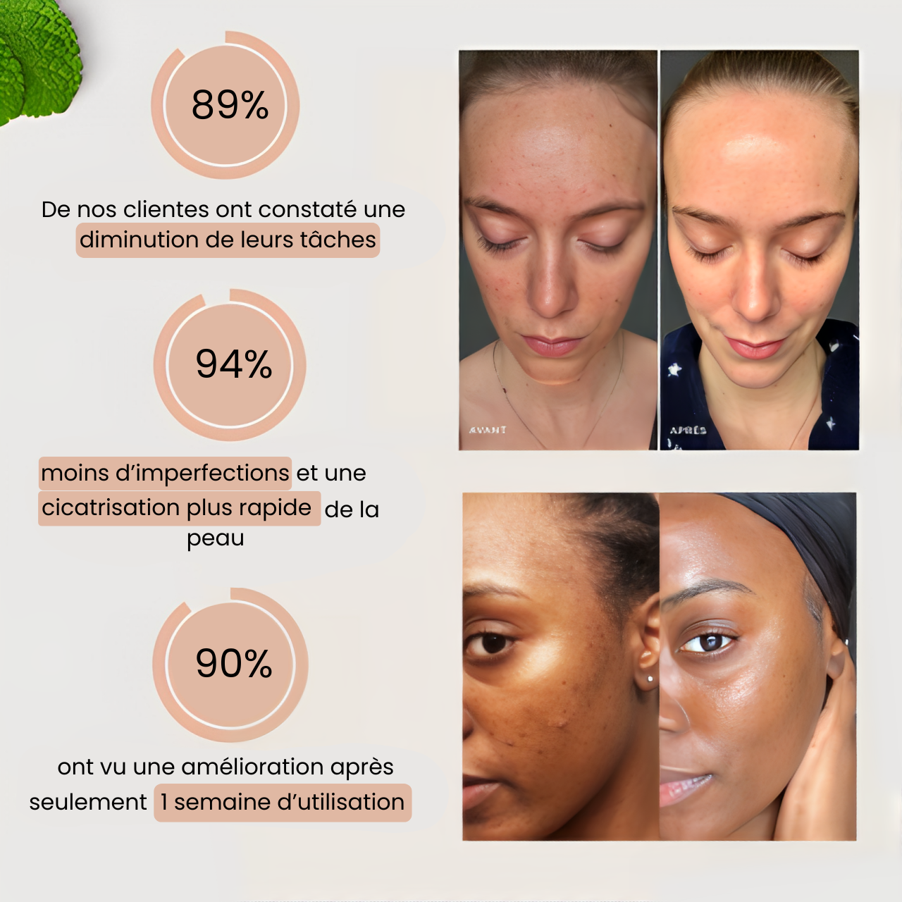 Routine Anti-Imperfections 4 en 1