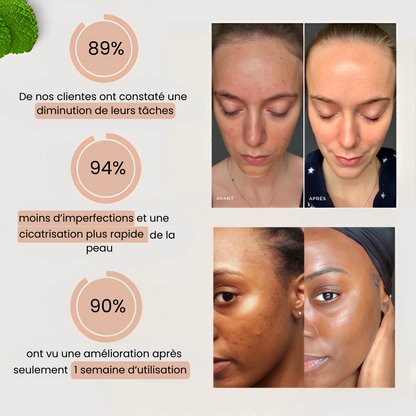 Routine Anti-Imperfections 4 en 1